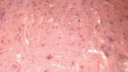 печеночные оладьи на сметане